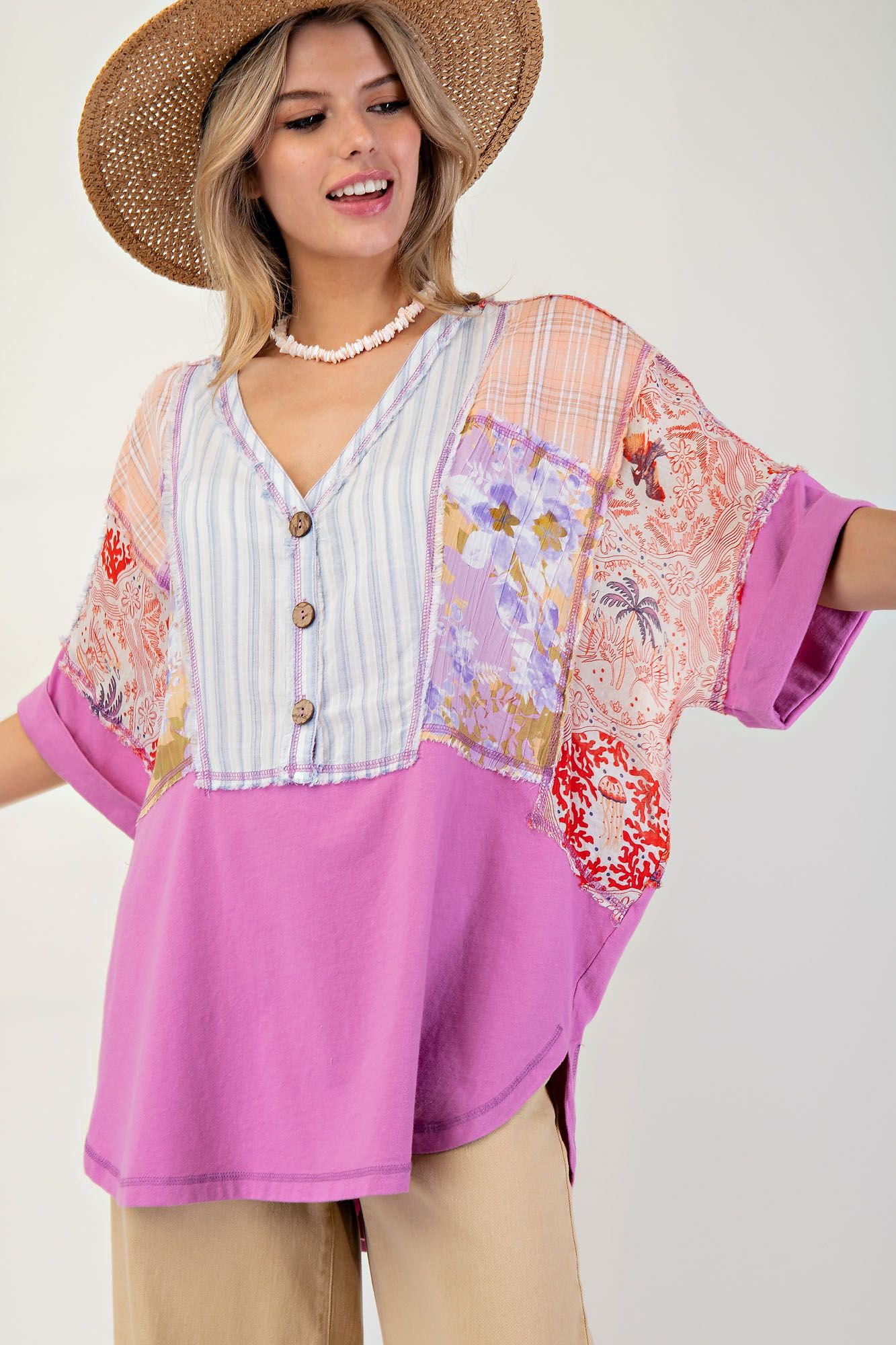 Mixed Pattern Cotton Jersey Tunic